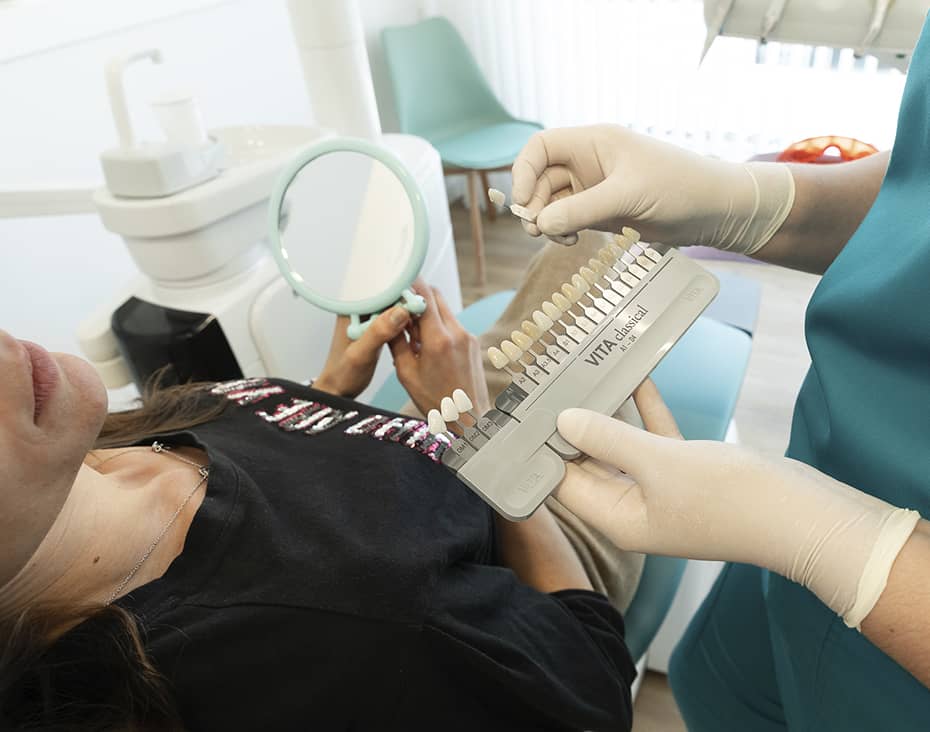 carillas dentales precio torremolinos