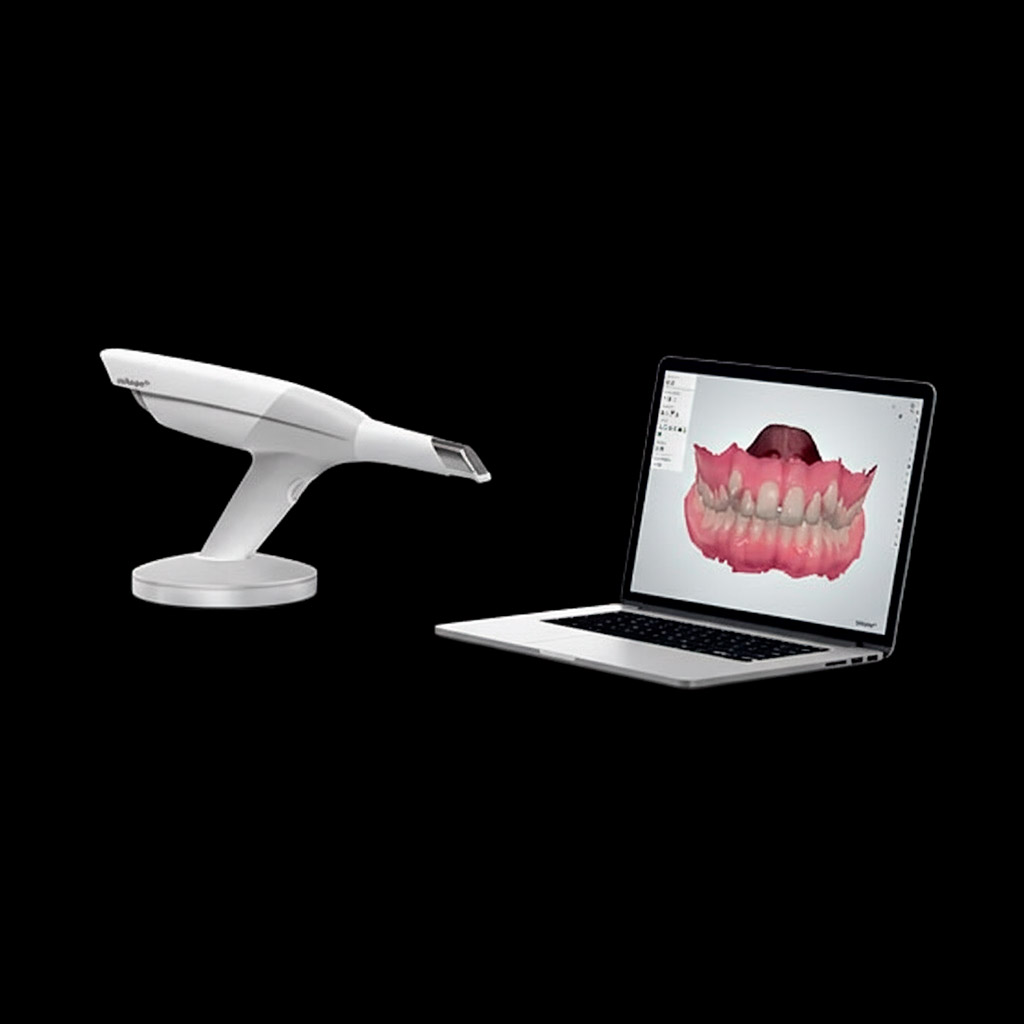 escaner cad cam dentista torremolinos